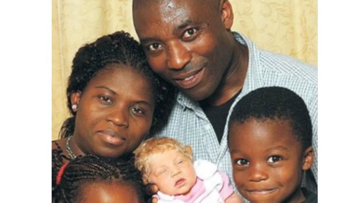Bebê loira nascida de pais nigerianos intriga cientistas