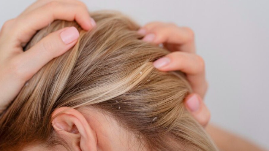 Scalp care: dermatologista dá dicas de cuidados com o couro cabeludo durante a primavera