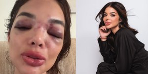 "Ia morrer ali", conta mulher agredida por empresário em SP