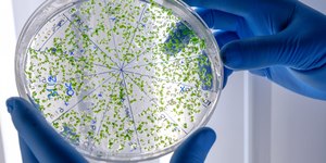 Superbactérias são achadas em aves silvestres em Santos (SP)