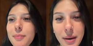 Ana Castela revela diagnóstico após surgir com olho inchado