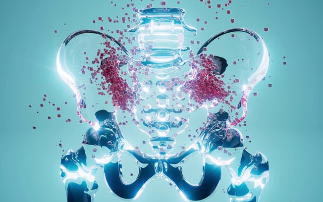 Cirurgia robótica amplia tratamento da endometriose