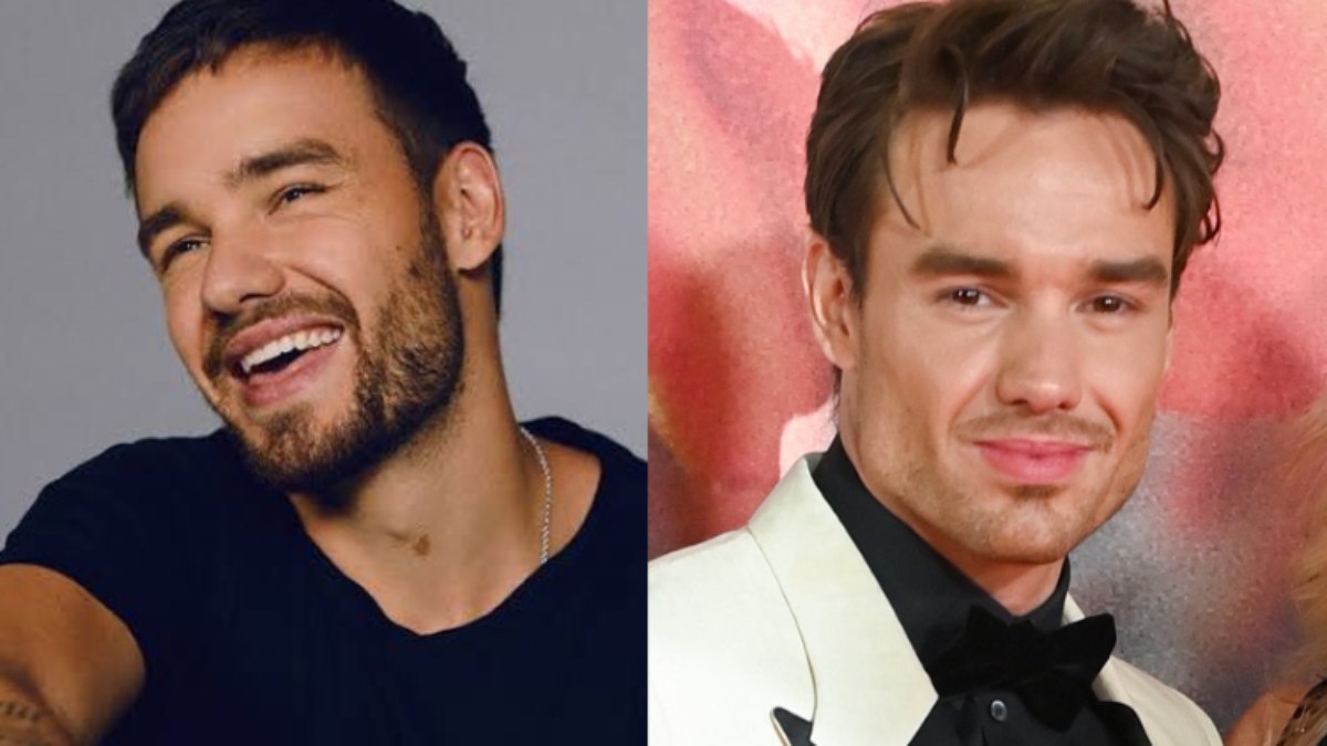 Rosto de Liam Payne choca web e fãs apontam harmonização