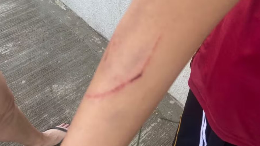 Mãe faz denúncia de agressão de professores a aluno