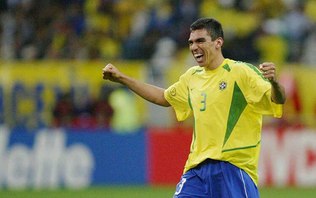 Lúcio mostra o rosto
pela primeira vez após sofrer queimaduras