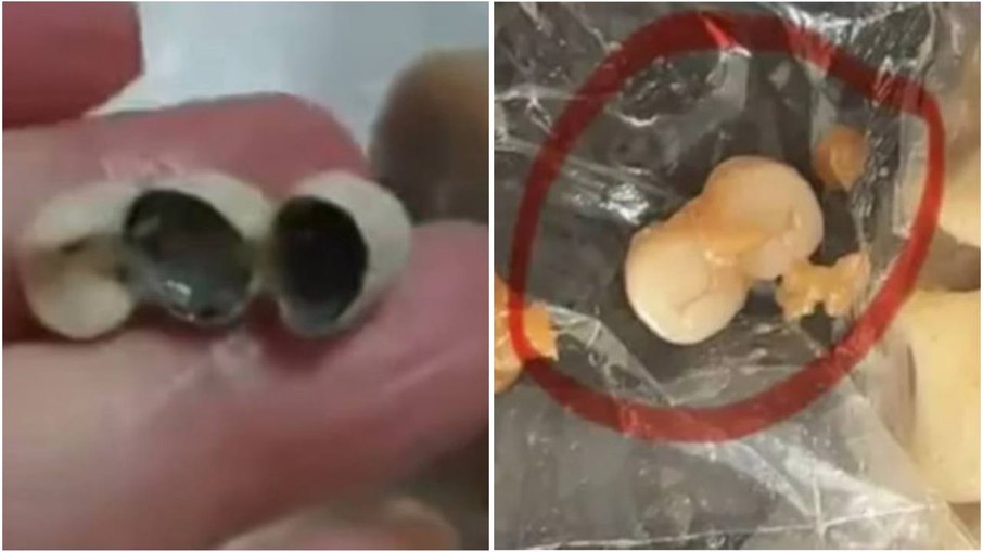 Cliente acha dentes humanos em alimentos na China Cliente acha dentes humanos em alimentos na China