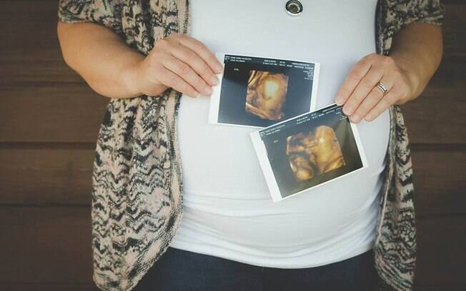 Como barriga de aluguel para a filha, Sheila Gump descobriu que estava grávida de um casal de gêmeos