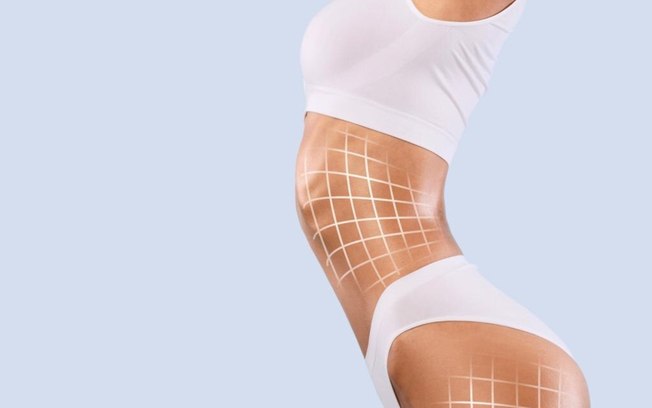 Lipo com tecnologias indica avanço na cirurgia plástica
