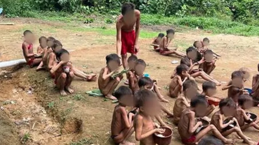 Crianças desnutridas na terra indígena Yanomami