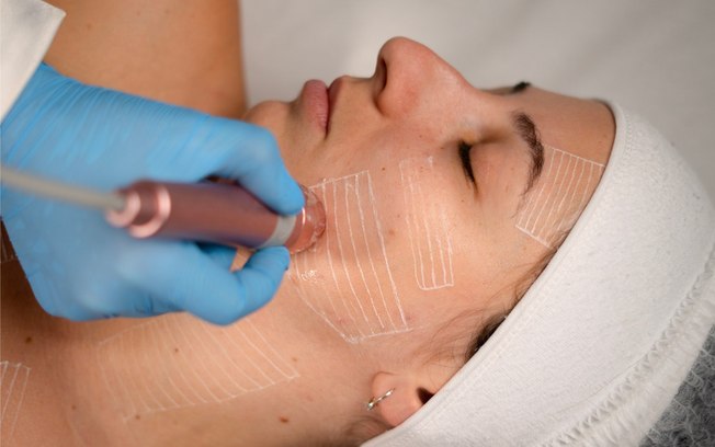 Rejuvenescimento facial movimenta setor estético no Brasil Rejuvenescimento facial movimenta setor estético no Brasil