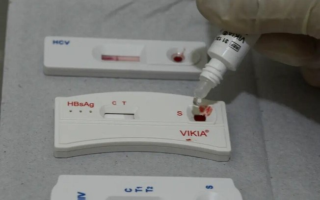 Farmácias poderão realizar testes rápidos de HIV e sífilis