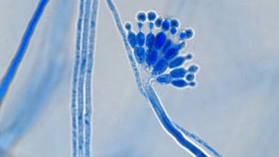 Aspergillus calidoustus