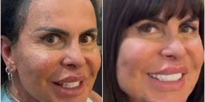 Gretchen choca seguidores ao exibe renovação do visual
