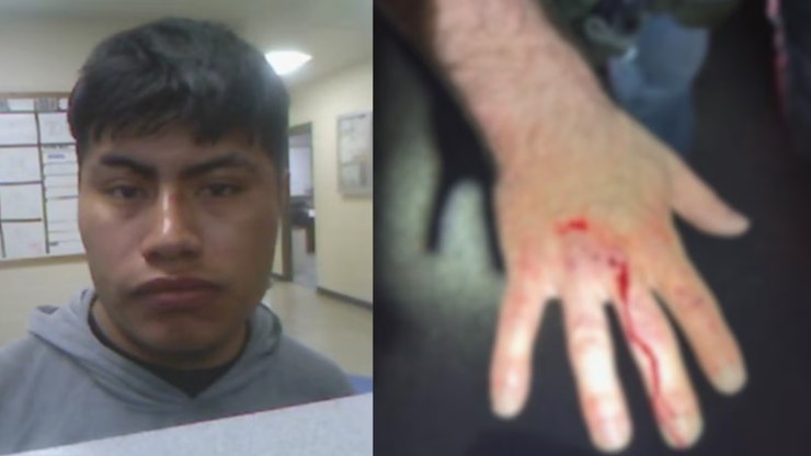 Imigrante ilegal morde a mão de policial para escapar da prisão