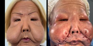 Juju do Pix: conheça a influenciadora que teve o rosto deformado