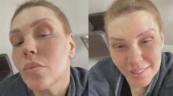 Em remissão do câncer, Simony mostra o cabelo crescendo