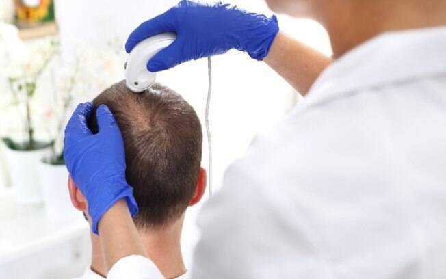 Queda de cabelo afeta a autoestima: tratamentos clínicos na tricologia são opção