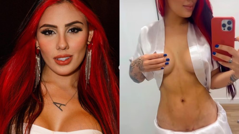 Irmã de MC Daniel mostra o corpo após lipoescultura; veja antes e depois