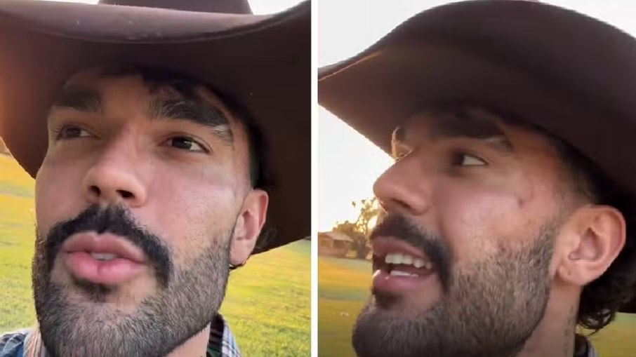 Luan Pereira exibe hematoma após briga com Dado Dolabella