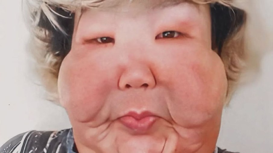 Juju do pix após aplicação de óleo mineral Juju do pix após aplicação de óleo mineral