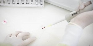 Casos suspeitos de Ebola no Brasil seguem sob investigação