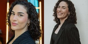 Diagnosticada com alopecia, Gretchen renova o visual