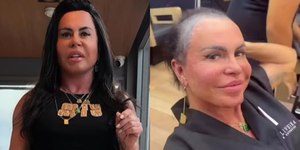 Gretchen surge sem prótese capilar e faz desabafo