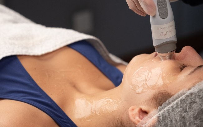 Ultrassom terapêutico avança no rejuvenescimento facial