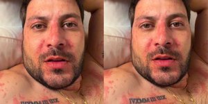 Ex-BBB Caio Afiune é internado após crise alérgica