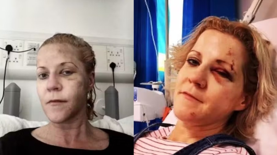 Mulher supera AVC, câncer e coma e vira exemplo de resiliência Mulher supera AVC, câncer e coma e vira exemplo de resiliência