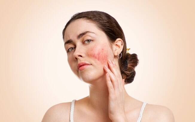 Descubra 3 fatores que deixam a pele mais irritada e sensível!