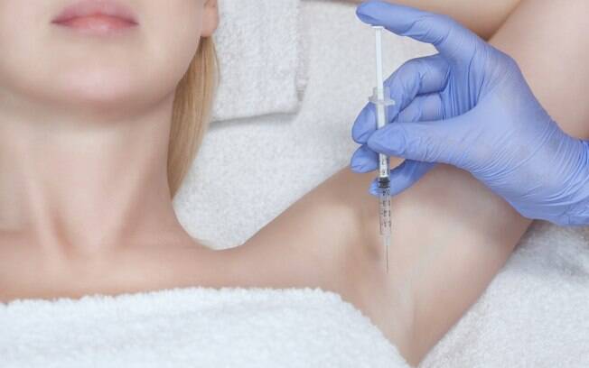 Injeções de botox nas axilas podem ser usadas como tratamento para casos de suor excessivo