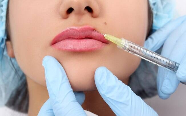 O preenchimento labial deve ser feito por profissionais qualificados e em clínicas adequadas
