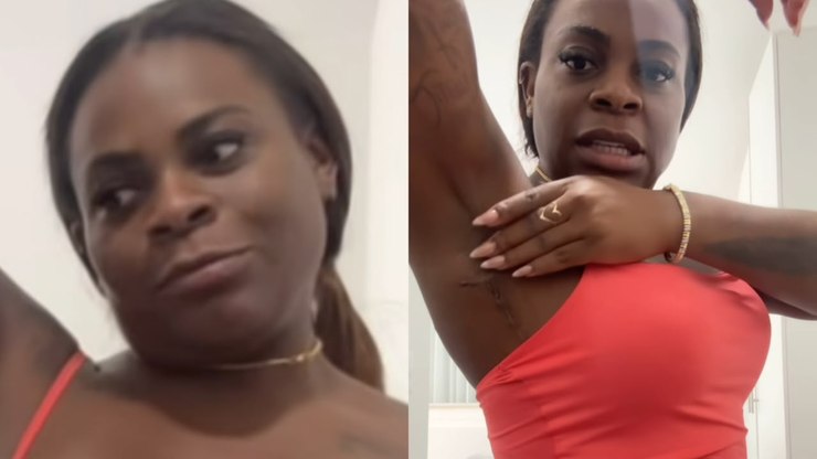 Jojo Todynho mostra cicatrizes de cirurgias após emagrecimento