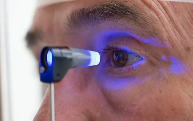 Sinais de glaucoma motivam adoção de exames regulares