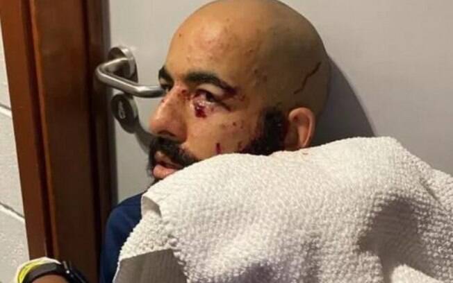Esposa de Danilo Fernandes publica nova foto do goleiro após ataque ao ônibus do Bahia: 'Sem acreditar'