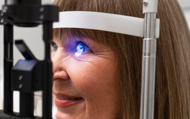 Procedimento a laser é alternativa para tratar o glaucoma