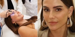 Deborah Secco faz transplante de sobrancelhas e elogia resultado