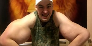 "Popeye" russo pode perder os dois braços por uso de esteróides