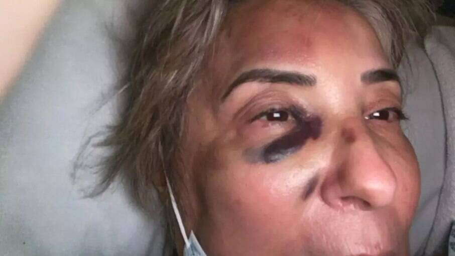Vítima mostra machucado após agressão cometida por advogado.