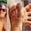 Yasmin Brunet e Gabriel Medina tatuaram uma carinha feliz no pé e a palavra "love" ("amor) na parte interna dos dedos da mão. Foto: Reprodução/Instagram
