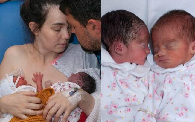 Emma Woodhouse dá à luz bebê natimorto e cuida de filha por duas semanas como se ela estivesse viva 
