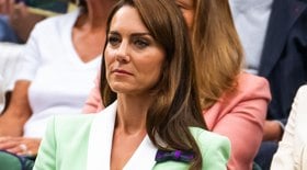 Kate Middleton recusa peruca e decide enfrentar câncer careca