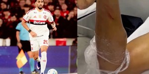 Com Ancelotti de olho, Paquetá escapa de fratura antes da Copa
