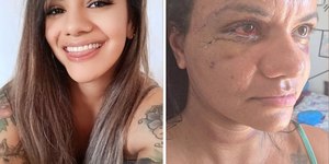 Vítima de 61 socos em elevador recebe homenagem em Natal