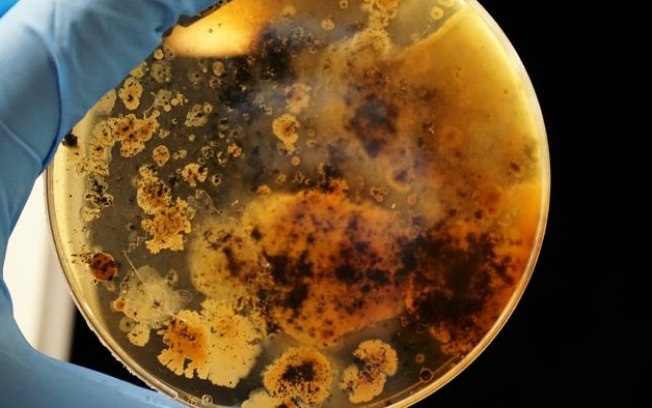 35 novas espécies de bactérias são descobertas em hospital