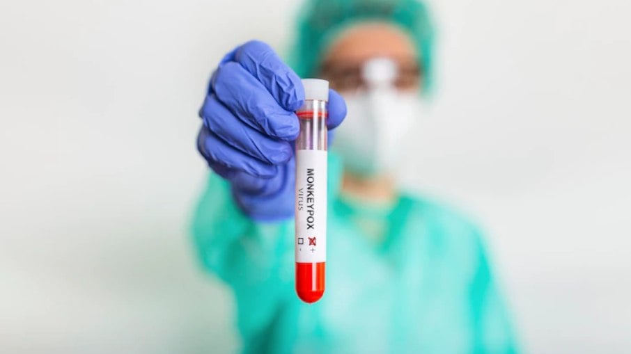 Teste para detectar a presença do vírus da varíola dos macacos