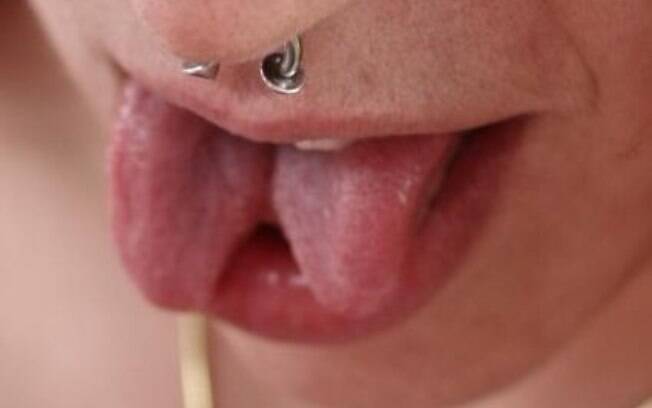 Língua bifurcada ou tongue splitting é a prática que consiste em cortar a língua ao meio Língua bifurcada ou tongue splitting é a prática que consiste em cortar a língua ao meio