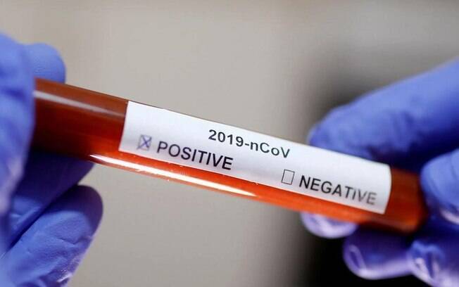 Novo coronavírus já contaminou mais de 520 mil no mundo, deixando 23 mil mortos até o momento da publicação desta matéria