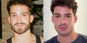 João Guilherme surge “diferente” e público suspeita de retoques